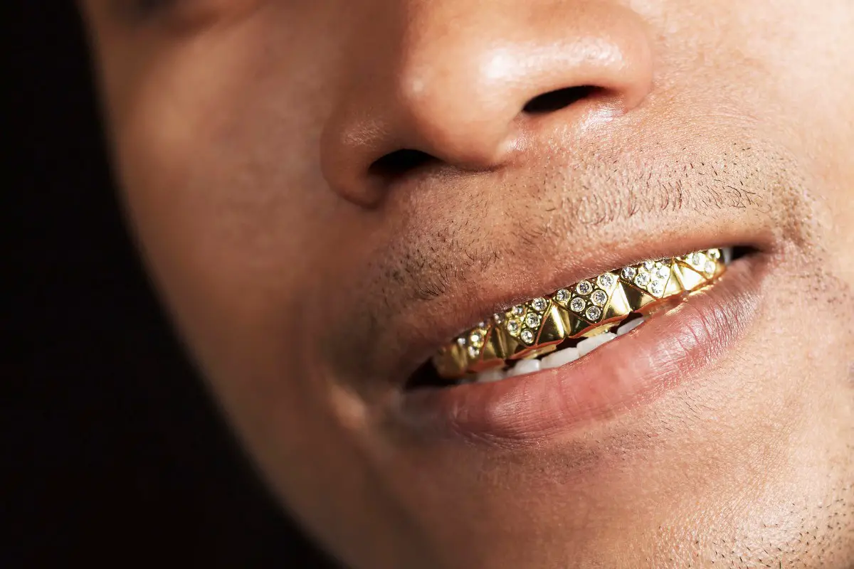 Man with gold teeth grill